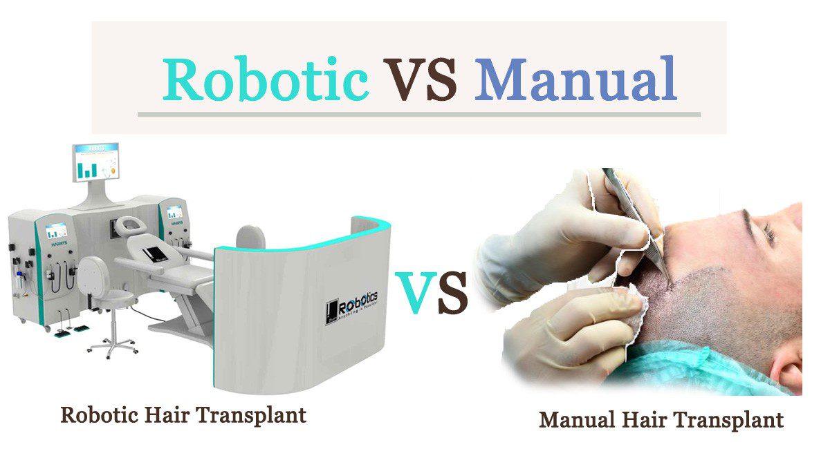 What Is the Difference Between a Robotic VS Manual Hair Transplant?